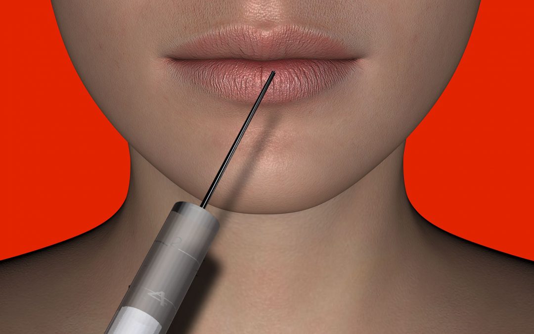 Een stralende look met Botox!